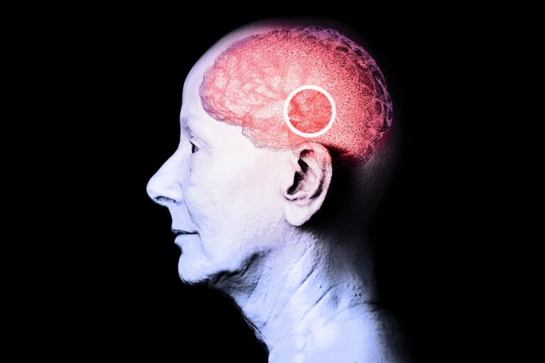 alzheimers degenerative neurological concept illustration with older woman